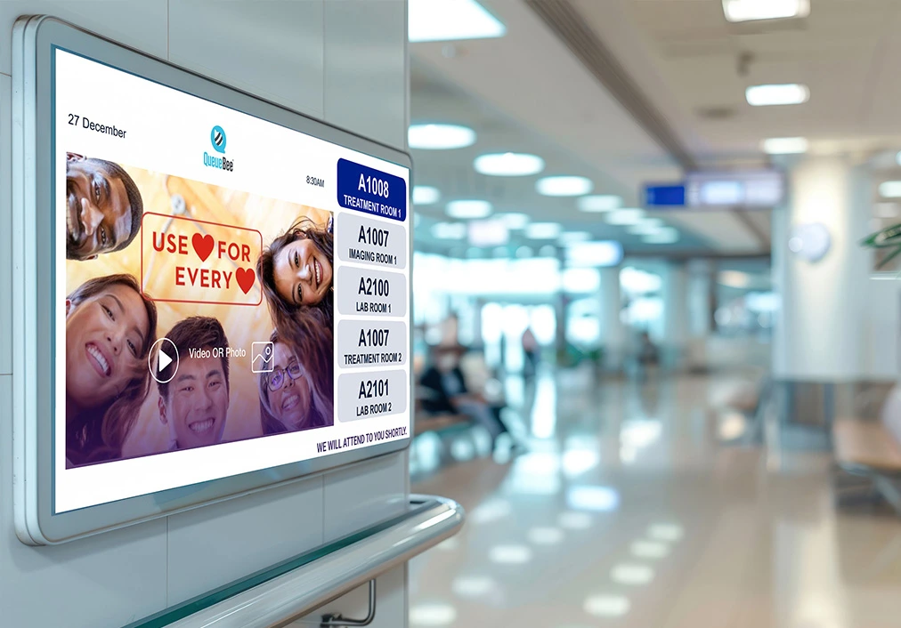 How do I choose a queue system for a retail store?